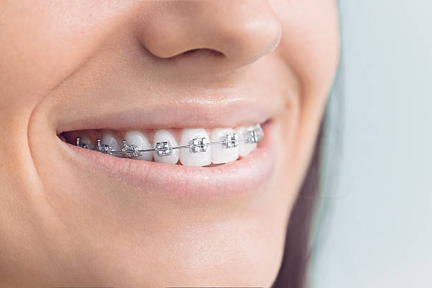 Best Veneers and Lumineers  in Bishop, TX